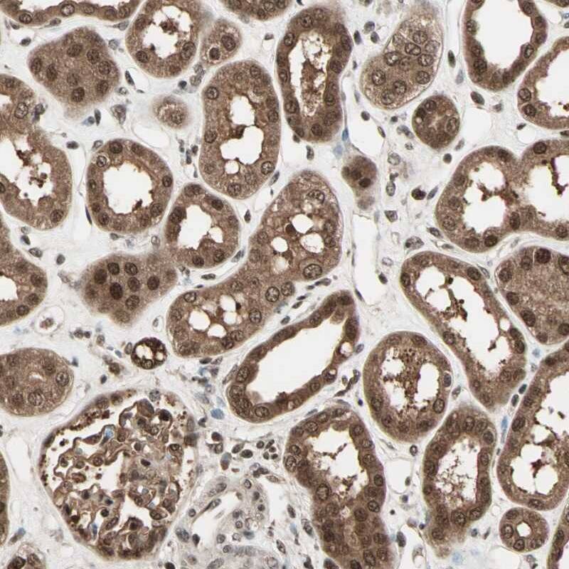 ZNF44 Antibody - BSA Free Immunohistochemistry-Paraffin: ZNF44 Antibody [NBP1-81344]