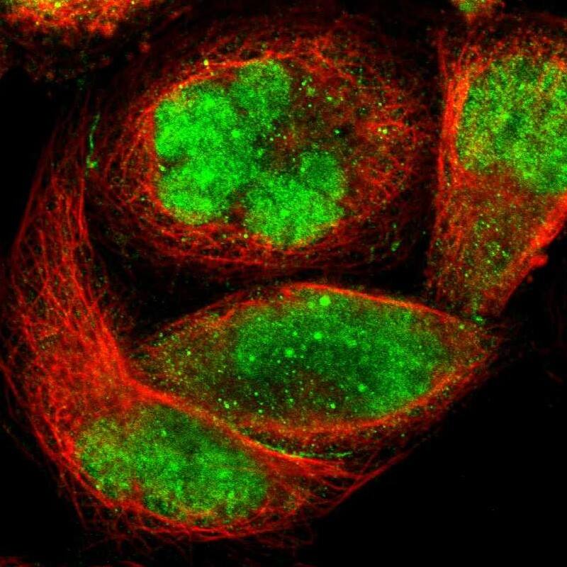 ZKSCAN1 Antibody - BSA Free Immunocytochemistry/ Immunofluorescence: ZKSCAN1 Antibody [NBP1-81346]