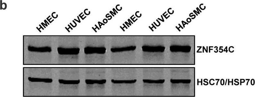 ZNF354C Antibody - BSA Free