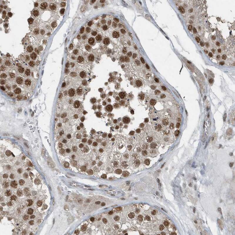YTHDC1 Antibody - BSA Free Immunohistochemistry-Paraffin: YTHDC1 Antibody [NBP1-81353]