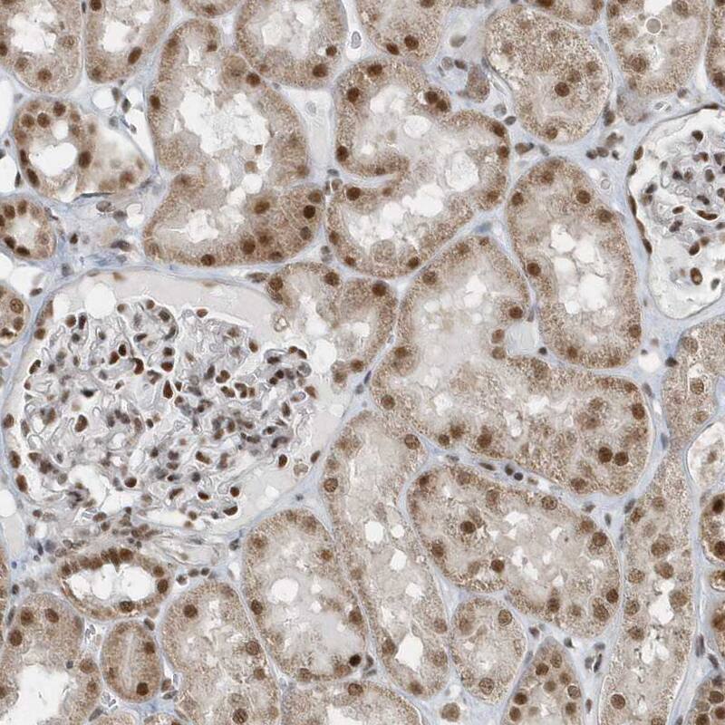 YTHDC1 Antibody - BSA Free Immunohistochemistry-Paraffin: YTHDC1 Antibody [NBP1-81353]