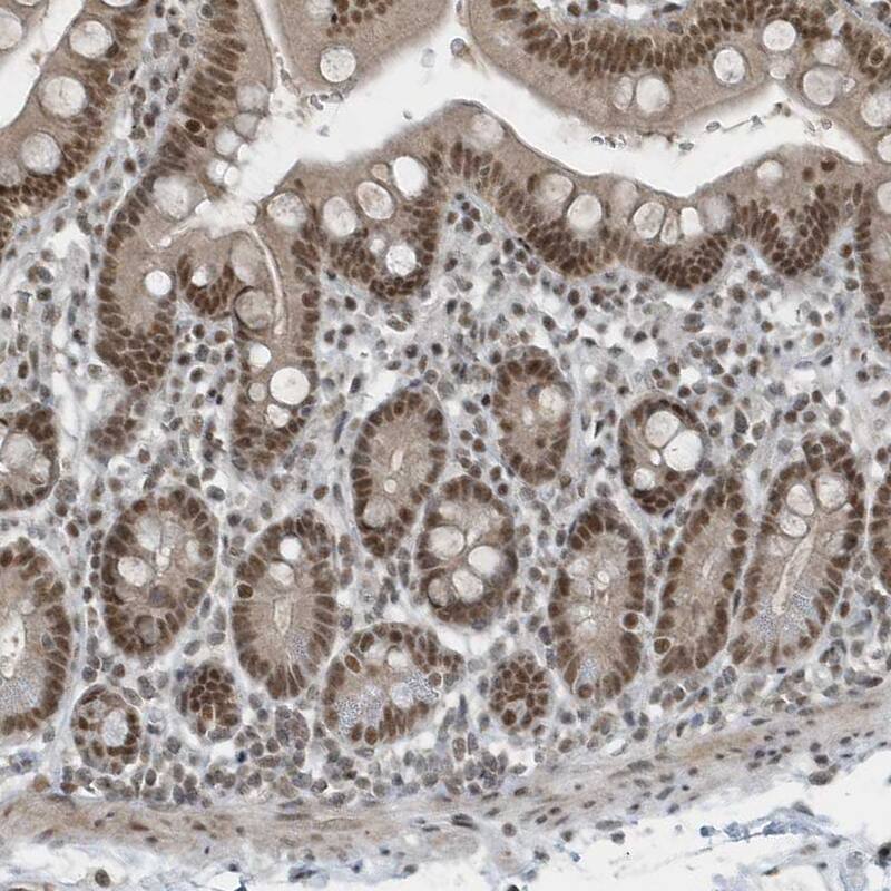 YTHDC1 Antibody - BSA Free Immunohistochemistry-Paraffin: YTHDC1 Antibody [NBP1-81353]