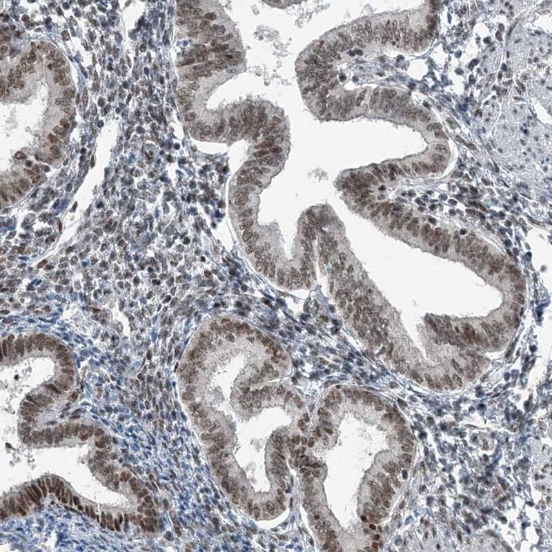 YTHDC1 Antibody - BSA Free Immunohistochemistry-Paraffin: YTHDC1 Antibody [NBP1-81353]
