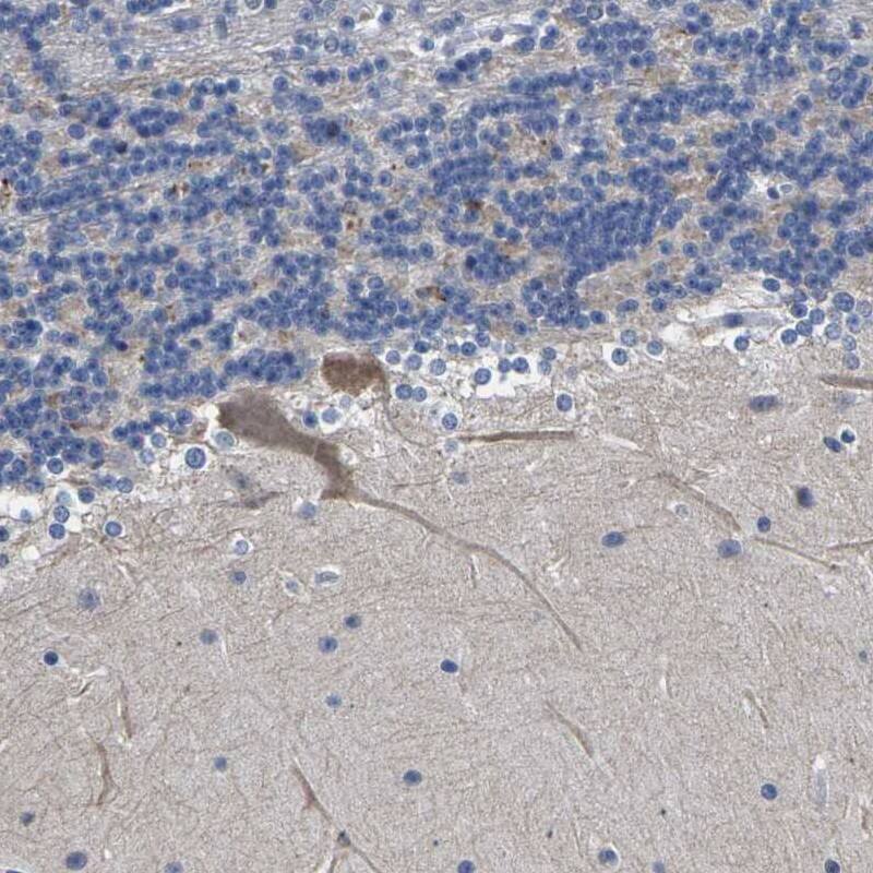 ST6 Gal Sialyltransferase 2/ST6GAL2 Antibody - BSA Free Immunohistochemistry: ST6 Gal Sialyltransferase 2/ST6GAL2 Antibody - BSA Free [NBP1-81364]