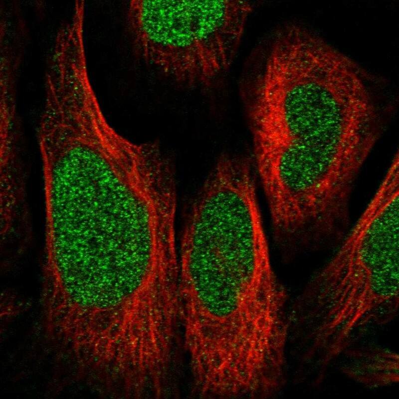 ZNF512 Antibody - BSA Free Immunocytochemistry/ Immunofluorescence: ZNF512 Antibody [NBP1-81371]