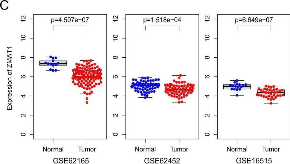 ZMAT1 Antibody - BSA Free