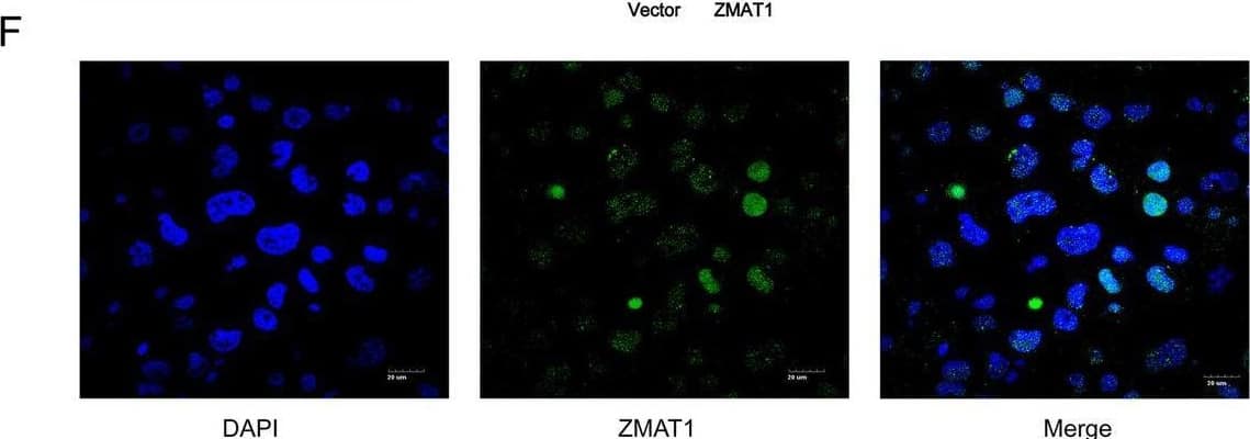 ZMAT1 Antibody - BSA Free