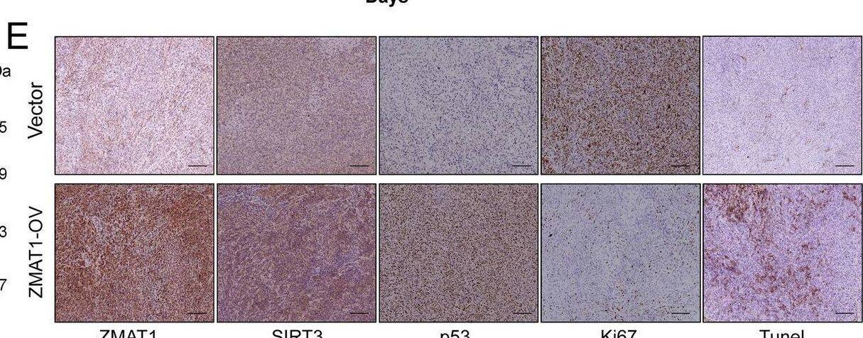 ZMAT1 Antibody - BSA Free