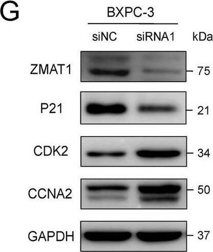 ZMAT1 Antibody - BSA Free