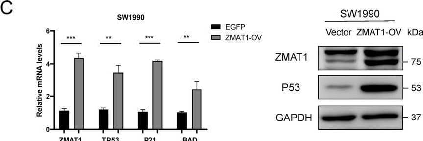 ZMAT1 Antibody - BSA Free