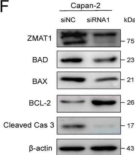 ZMAT1 Antibody - BSA Free