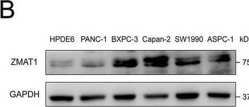 ZMAT1 Antibody - BSA Free