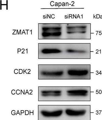 ZMAT1 Antibody - BSA Free