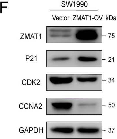 ZMAT1 Antibody - BSA Free