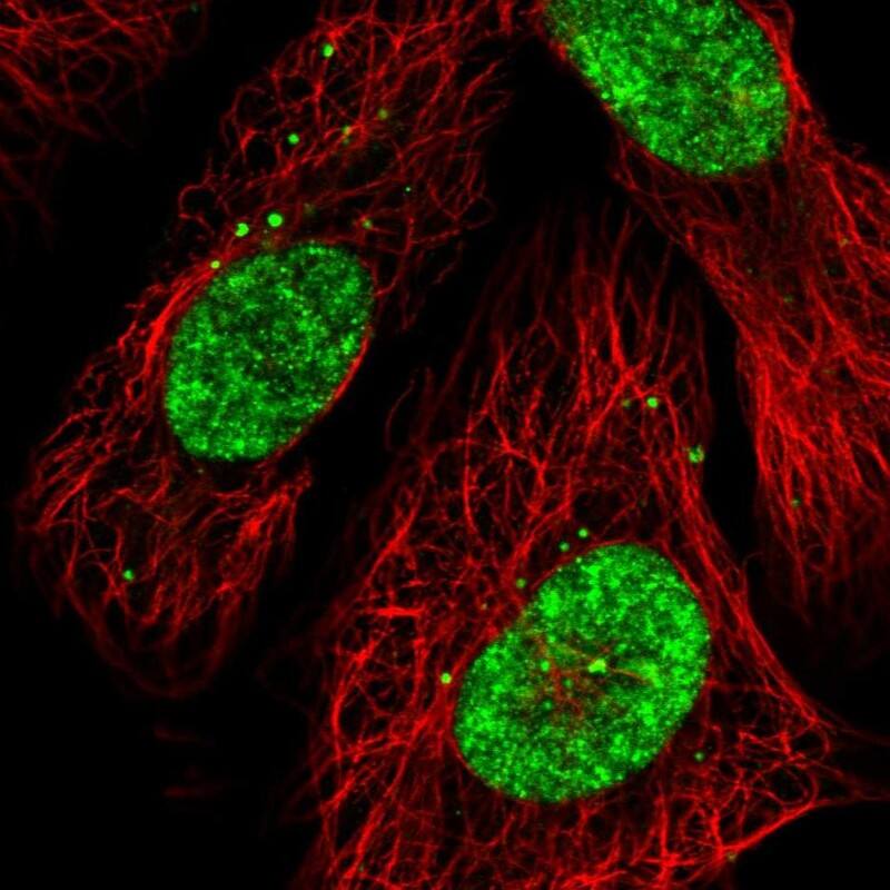 CECR2 Antibody - BSA Free Immunocytochemistry/ Immunofluorescence: CECR2 Antibody [NBP1-81378]