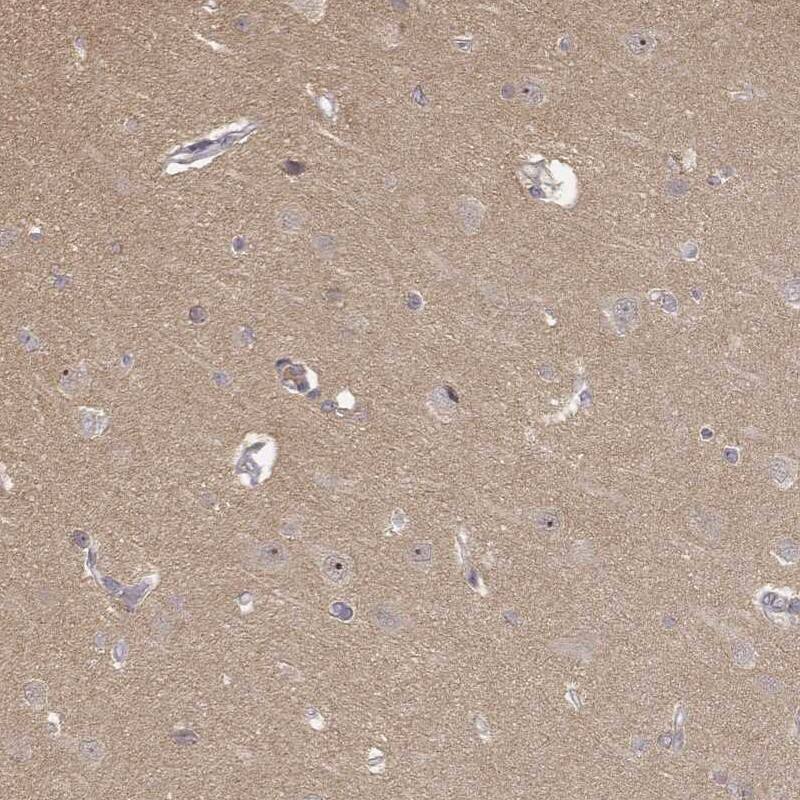 MED12L Antibody - BSA Free Immunohistochemistry-Paraffin: MED12L Antibody [NBP1-81391]