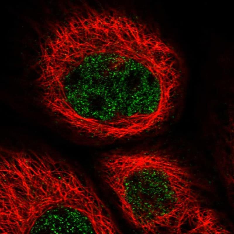 ZNF529 Antibody - BSA Free Immunocytochemistry/ Immunofluorescence: ZNF529 Antibody [NBP1-81396]
