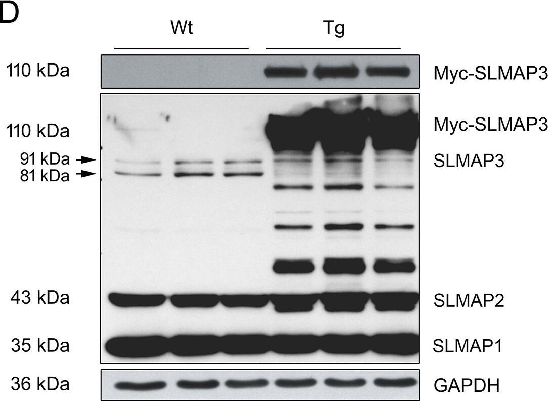 SLMAP Antibody