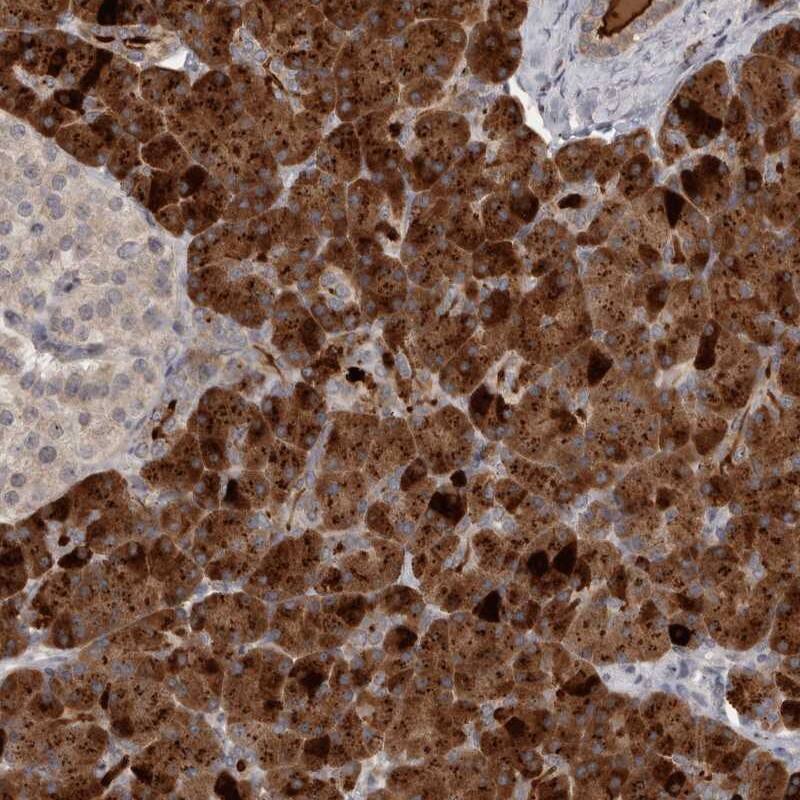 ZFP14 Antibody - BSA Free Immunohistochemistry-Paraffin: ZFP14 Antibody [NBP1-81401]