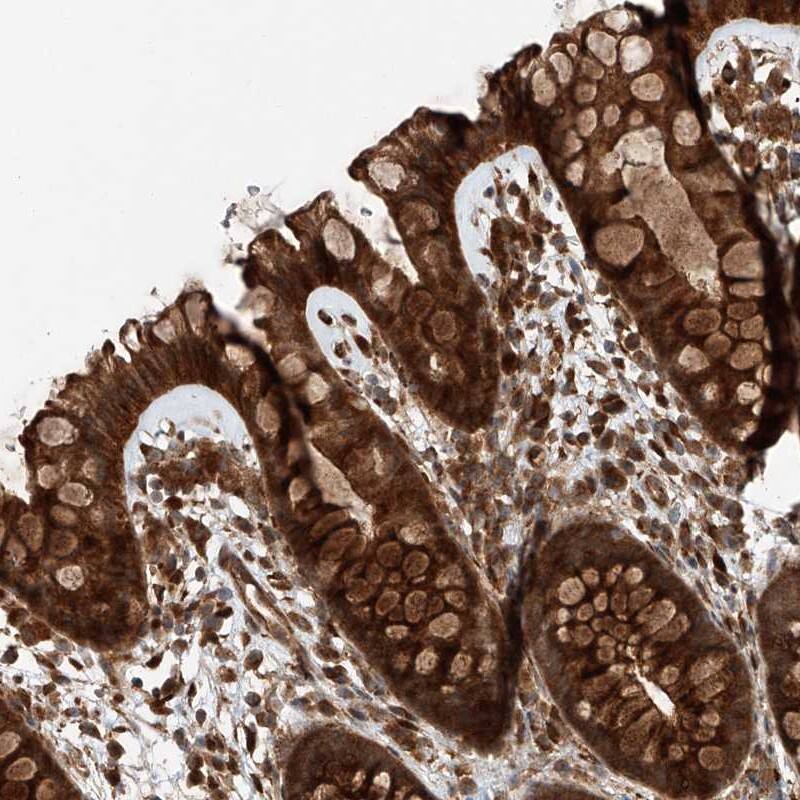 ZFP28 Antibody - BSA Free Immunohistochemistry-Paraffin: ZFP28 Antibody [NBP1-81408]