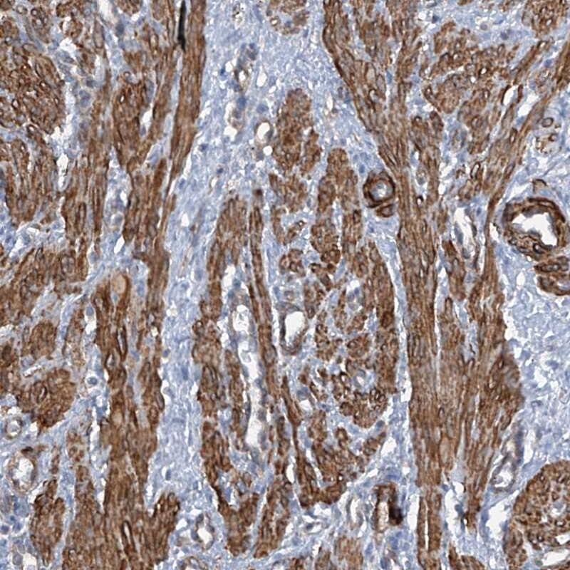 ZNF490 Antibody - BSA Free Immunohistochemistry-Paraffin: ZNF490 Antibody [NBP1-81432]