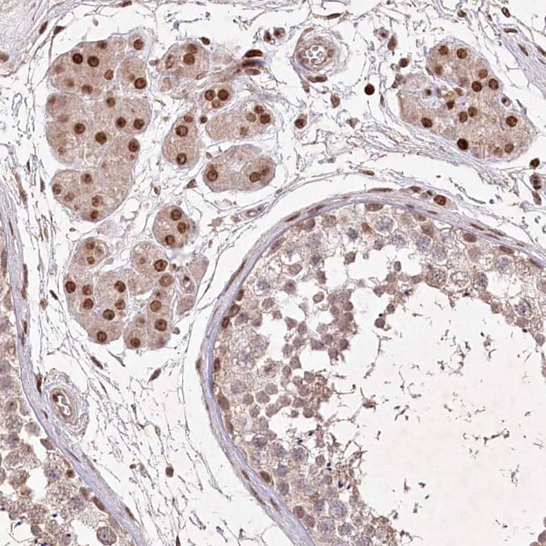 FAM190B Antibody - BSA Free Immunohistochemistry-Paraffin: FAM190B Antibody [NBP1-81439]