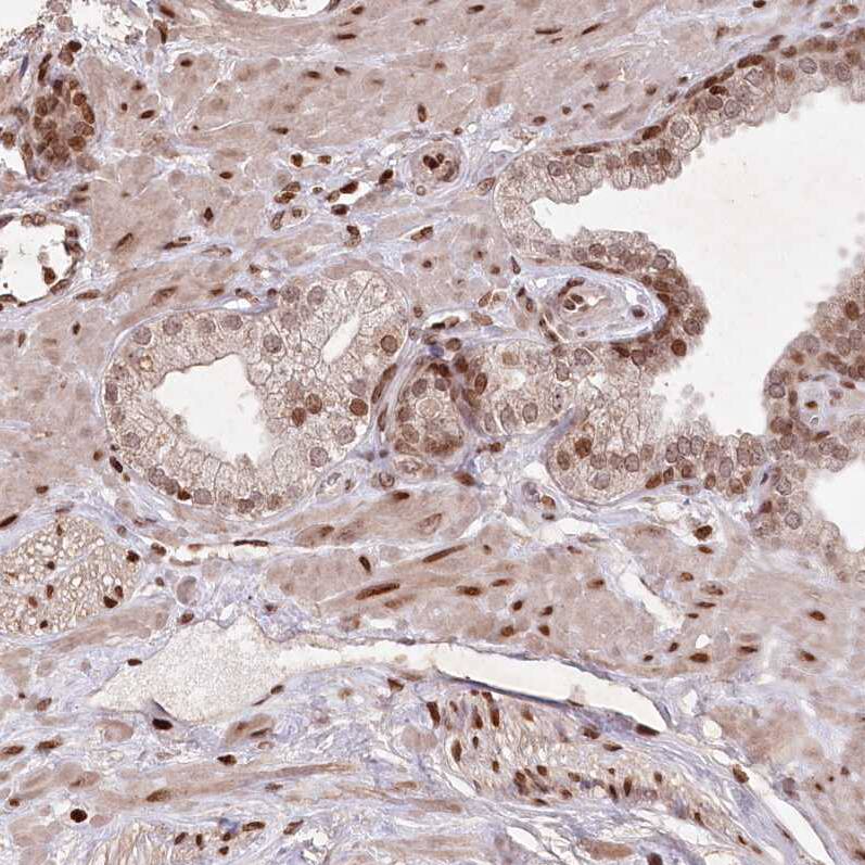 FAM190B Antibody - BSA Free Immunohistochemistry-Paraffin: FAM190B Antibody [NBP1-81439]