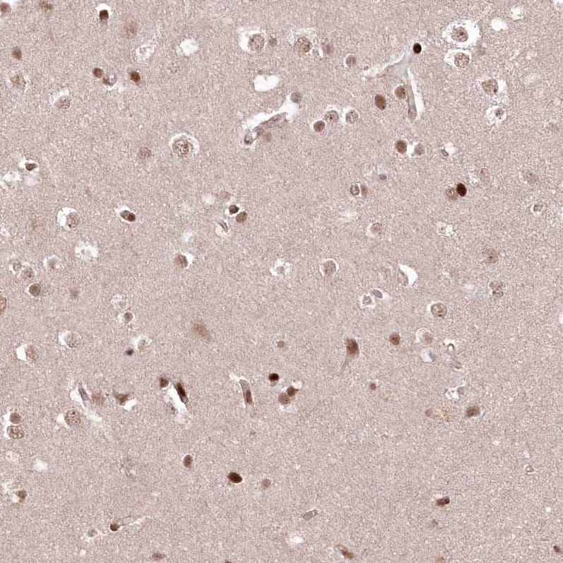 FAM190B Antibody - BSA Free Immunohistochemistry-Paraffin: FAM190B Antibody [NBP1-81439]