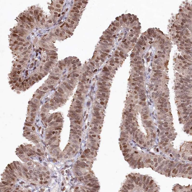 FAM190B Antibody - BSA Free Immunohistochemistry-Paraffin: FAM190B Antibody [NBP1-81439]