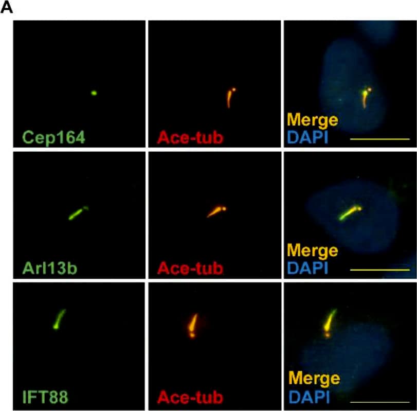 CEP164 Antibody