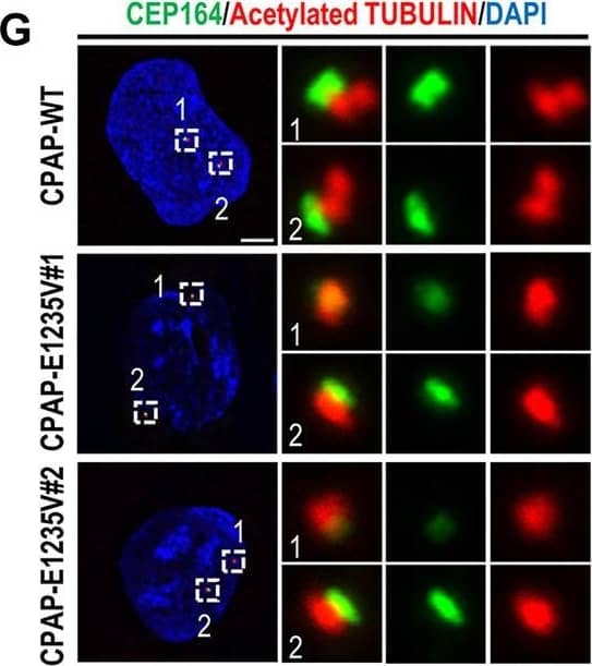CEP164 Antibody