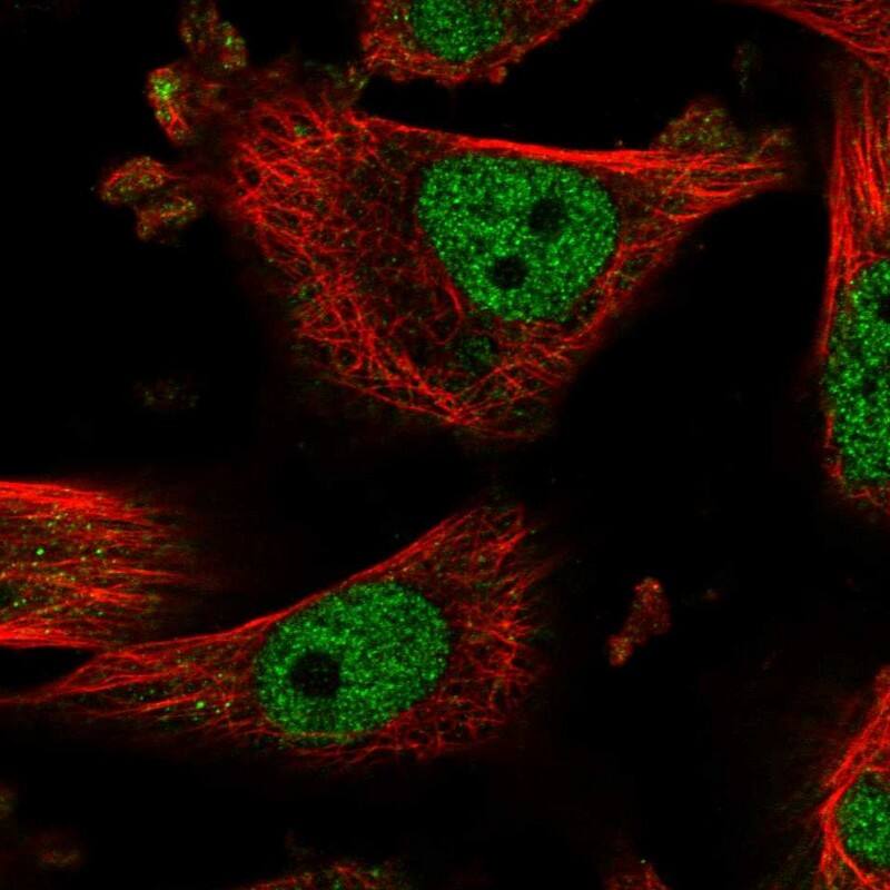 R3HDM2 Antibody - BSA Free Immunocytochemistry/ Immunofluorescence: R3HDM2 Antibody [NBP1-81448]