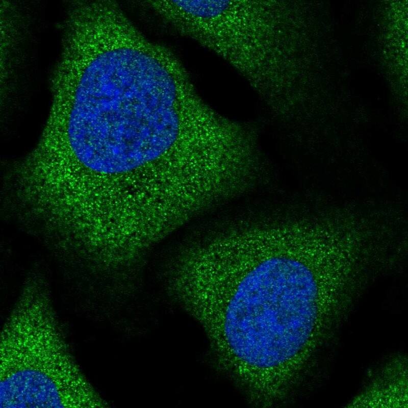 ZFP30 Antibody - BSA Free Immunocytochemistry/ Immunofluorescence: ZFP30 Antibody [NBP1-81455]