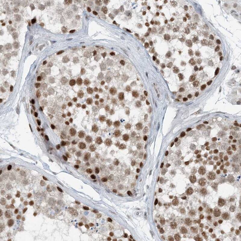 ZNF500 Antibody - BSA Free Immunohistochemistry-Paraffin: ZNF500 Antibody [NBP1-81502]