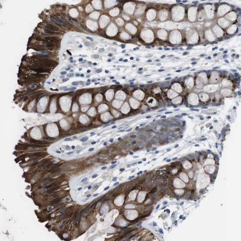 WSCD1 Antibody - BSA Free Immunohistochemistry-Paraffin: WSCD1 Antibody [NBP1-81503]