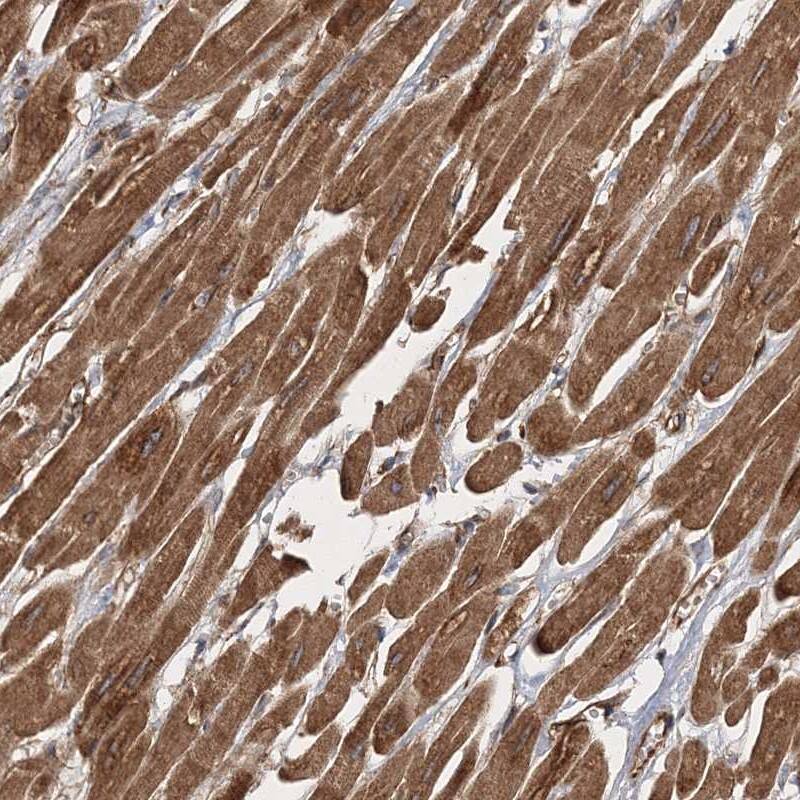 ZFYVE16 Antibody - BSA Free Immunohistochemistry-Paraffin: ZFYVE16 Antibody [NBP1-81517]