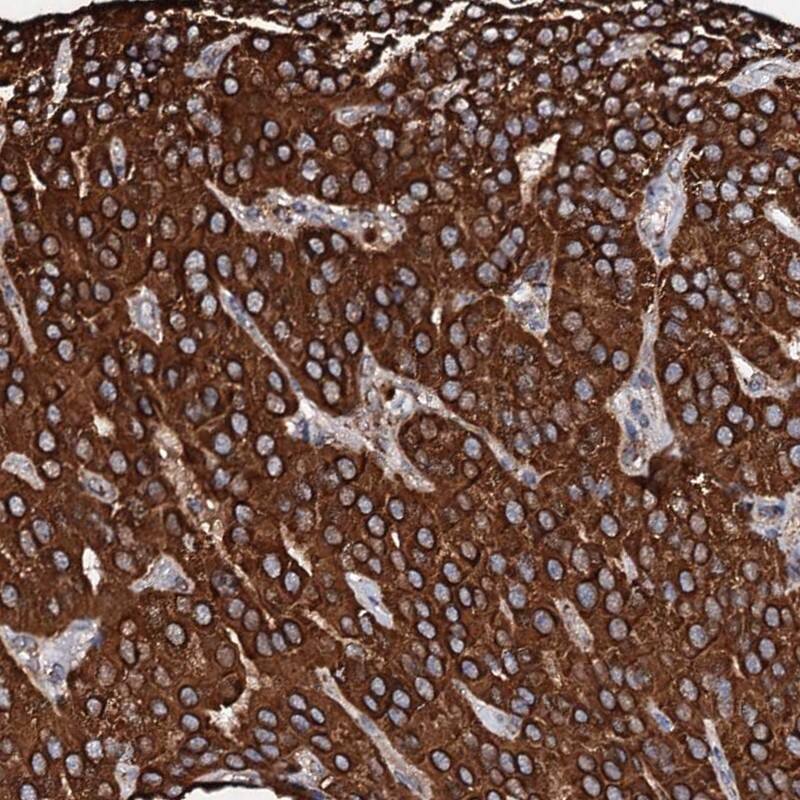 SECISBP2L Antibody - BSA Free Immunohistochemistry-Paraffin: SECISBP2L Antibody [NBP1-81530]