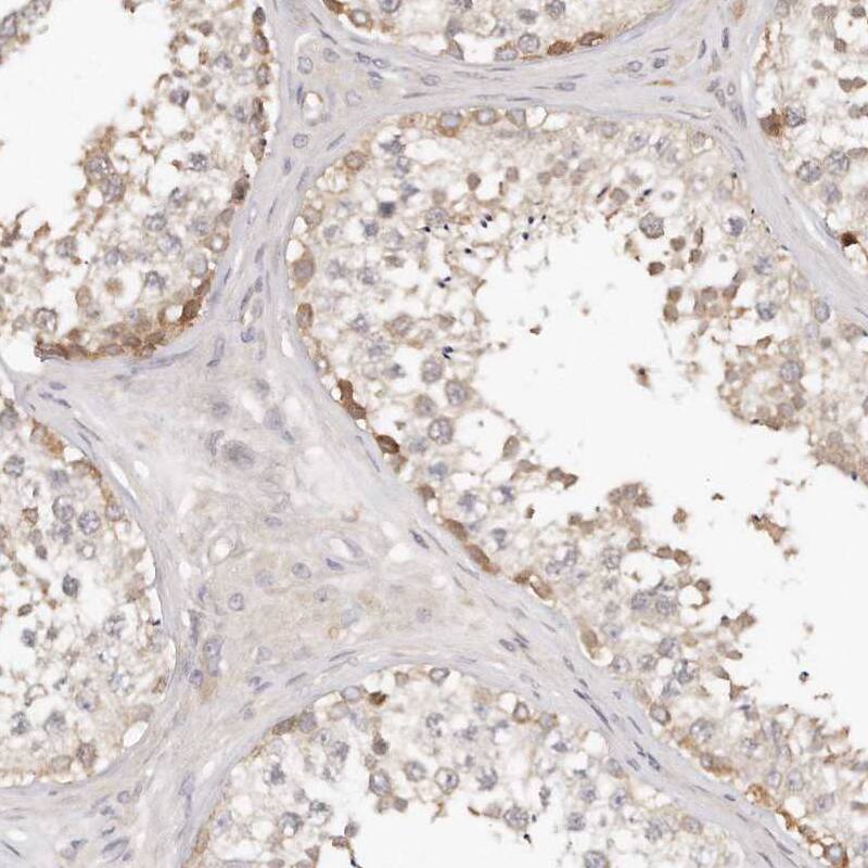 TTLL4 Antibody - BSA Free Immunohistochemistry-Paraffin: TTLL4 Antibody [NBP1-81535]