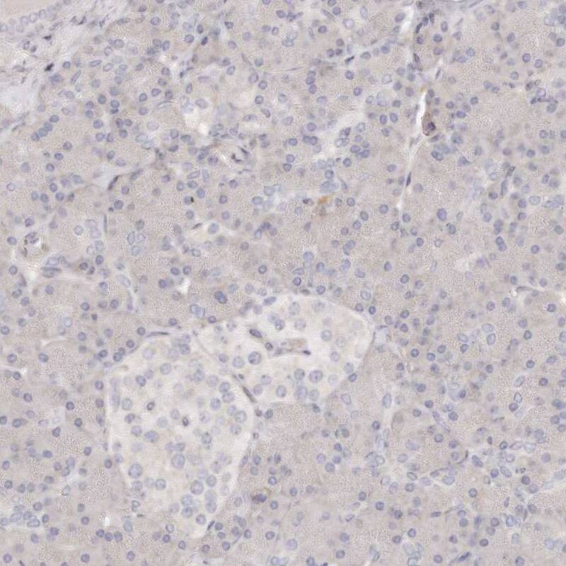TTLL4 Antibody - BSA Free Immunohistochemistry-Paraffin: TTLL4 Antibody [NBP1-81535]