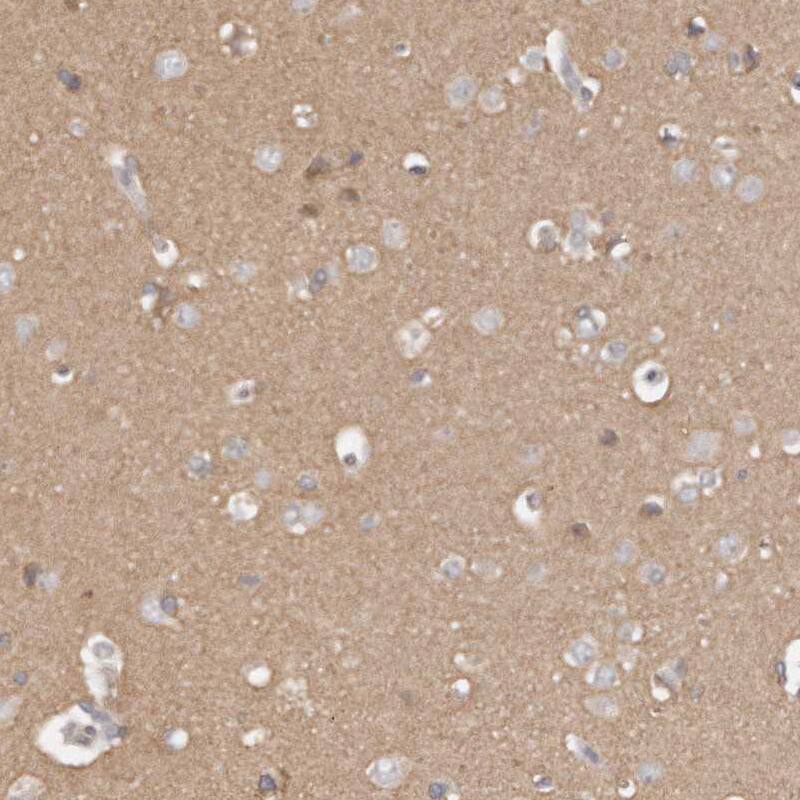 TTLL4 Antibody - BSA Free Immunohistochemistry-Paraffin: TTLL4 Antibody [NBP1-81535]