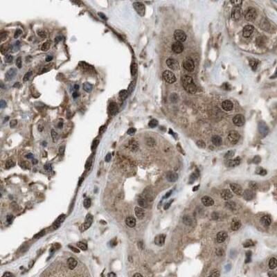 SERTAD2 Antibody - BSA Free Immunohistochemistry-Paraffin: SERTAD2 Antibody [NBP1-81542]