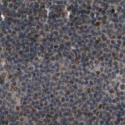 SERTAD2 Antibody - BSA Free Immunohistochemistry-Paraffin: SERTAD2 Antibody [NBP1-81542]
