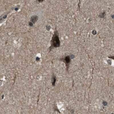 SERTAD2 Antibody - BSA Free Immunohistochemistry-Paraffin: SERTAD2 Antibody [NBP1-81542]