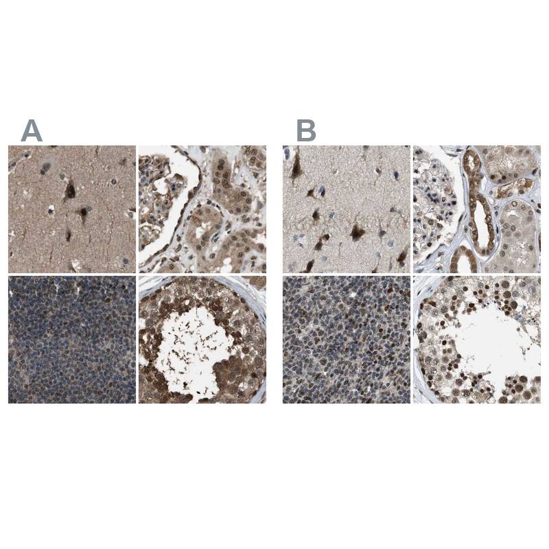 SERTAD2 Antibody - BSA Free Immunohistochemistry-Paraffin: SERTAD2 Antibody [NBP1-81542]