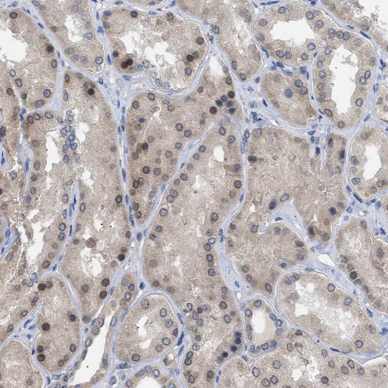 NUP93 Antibody - BSA Free Immunohistochemistry-Paraffin: NUP93 Antibody [NBP1-81546]