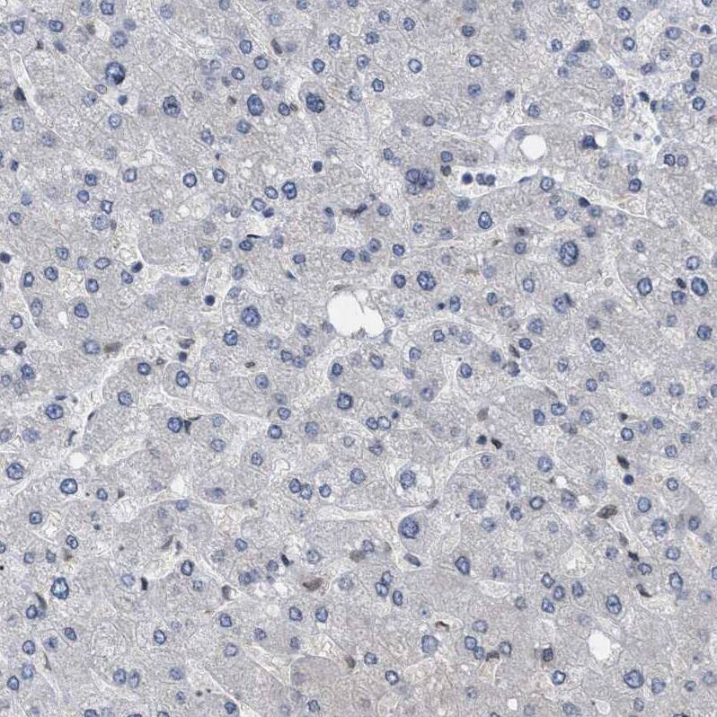 NUP93 Antibody - BSA Free Immunohistochemistry-Paraffin: NUP93 Antibody [NBP1-81546]