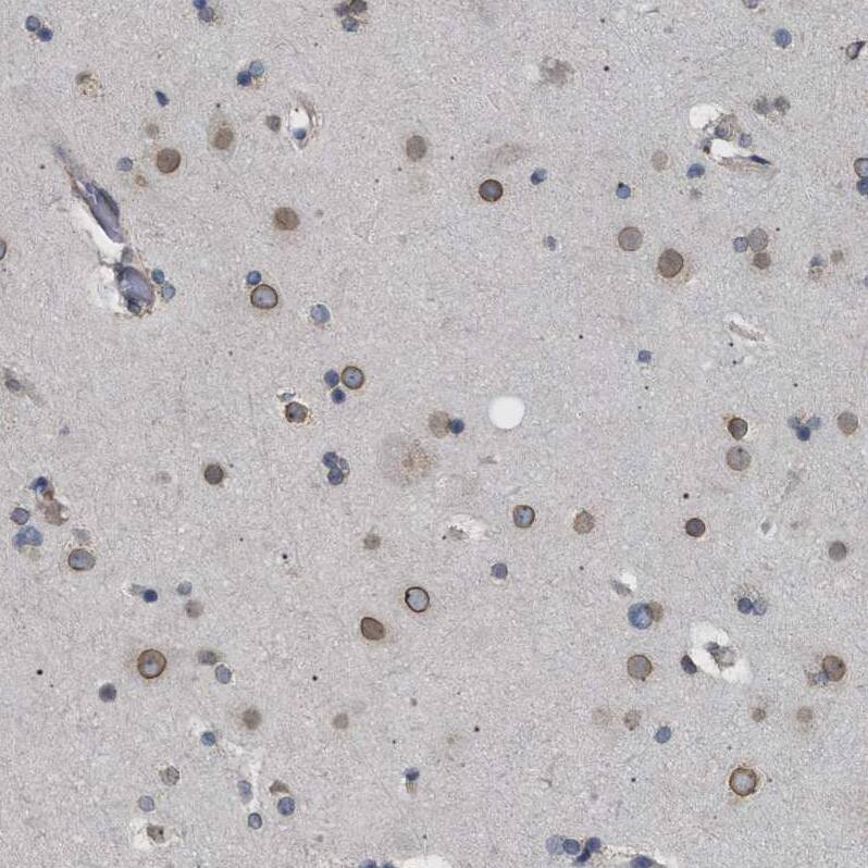 NUP93 Antibody - BSA Free Immunohistochemistry-Paraffin: NUP93 Antibody [NBP1-81546]