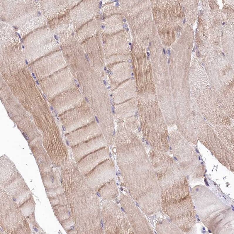 TNPO3 Antibody - BSA Free Immunohistochemistry-Paraffin: TNPO3 Antibody [NBP1-81585]