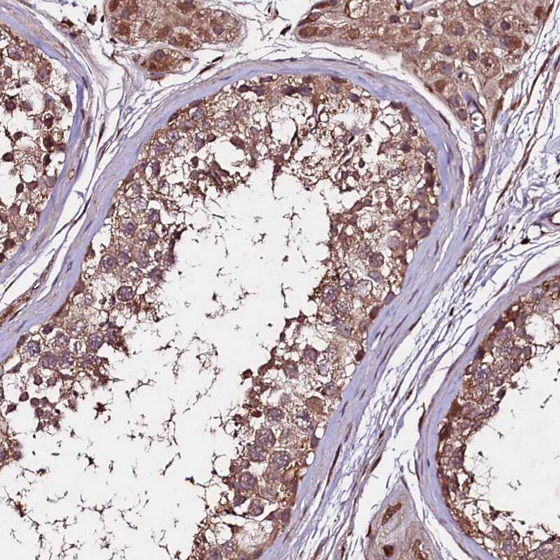 TNPO3 Antibody - BSA Free Immunohistochemistry-Paraffin: TNPO3 Antibody [NBP1-81585]