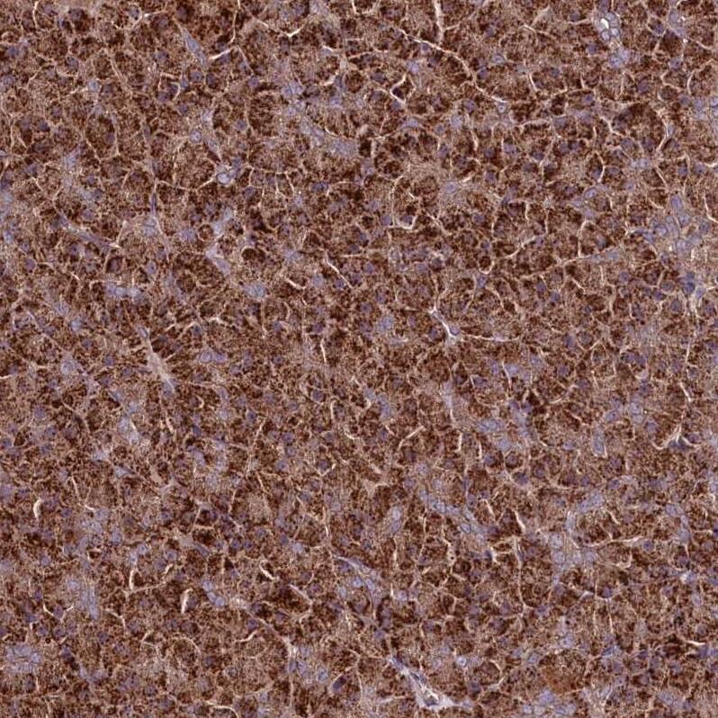 TNPO3 Antibody - BSA Free Immunohistochemistry-Paraffin: TNPO3 Antibody [NBP1-81585]